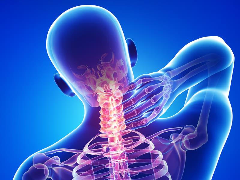 stylized x-ray of neck pain