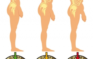 A picture showing the progression of osteoporosis as you age
